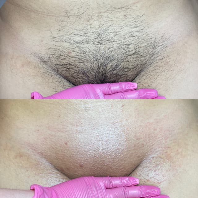 Package of 4 Brazilian Waxes at Pink Crab Wax Bar in Las Vegas, NV